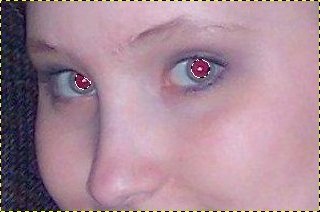red eye pupils selected